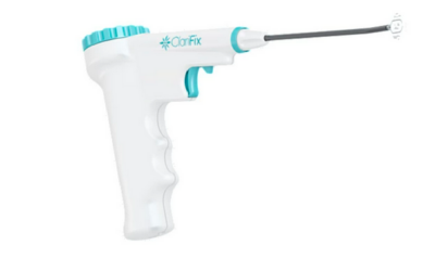 Explore the Potential of Expired Medical Equipment: The Case of the Stryker CFX-2000 ClariFix®